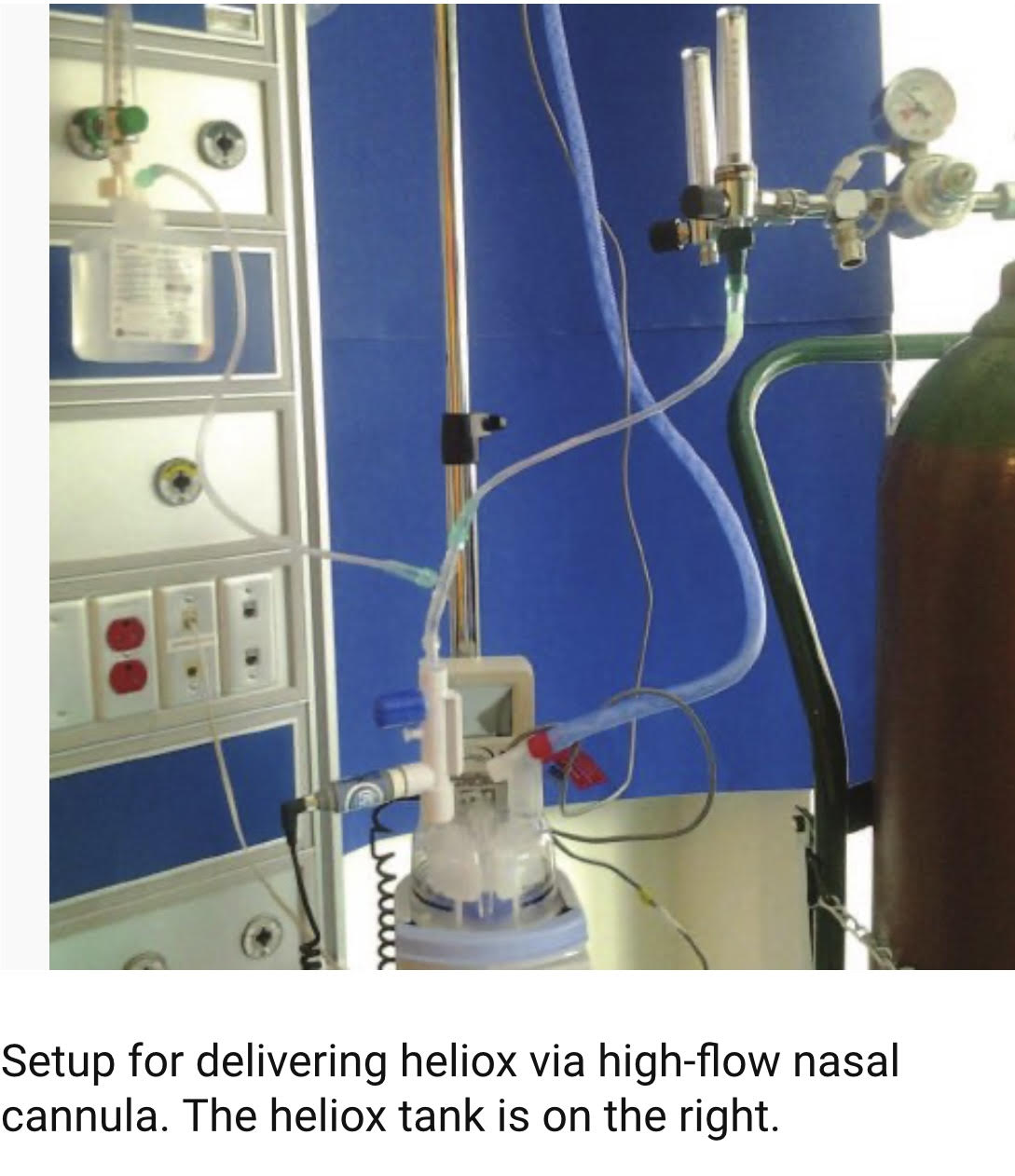 IANIV- NIV in Medicinal Gas ( Heliox and nitric oxide). Assembly and ...